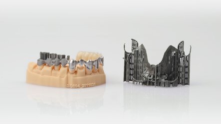 Dental model with three production steps (printing, polishing and finishing) of dental bridges and a denture still with support structures | © EOS