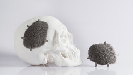 Alphaform Novaxdma Skull Implant | © EOS
