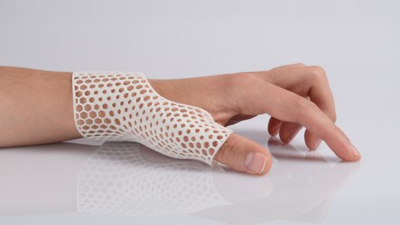 PA1101 hand orthosis from EOS in mesh design | © EOS