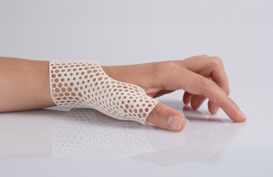 Additive manufacturing in the medical industry: 3D-printed concept of a hand orthosis